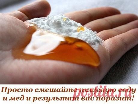 Просто cмешайте пищевую соду и мед.
Прекрасный рецепт!