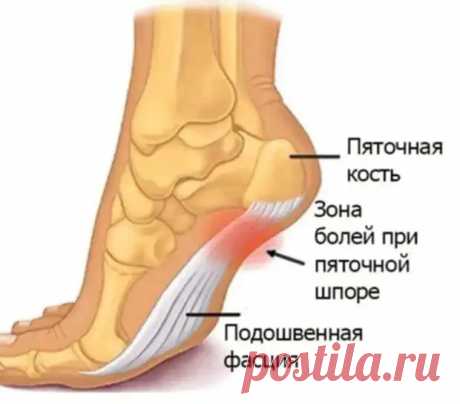 Когда шпора - не шпора