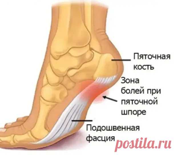 Когда шпора - не шпора