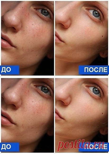 (50) Одноклассники