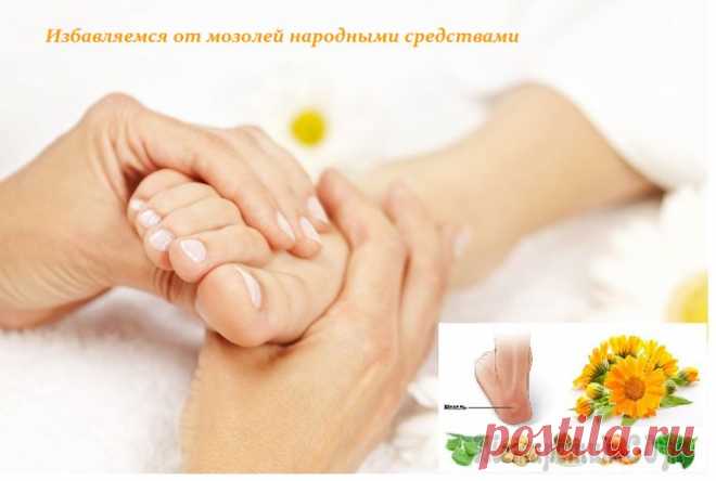 Народные средства для эффективного удаления натоптышей и мозолей