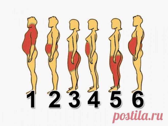 6 типов ожирения и как справиться с каждым из них