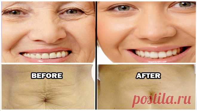 Как подтянуть кожу естественно Результаты будут удивлены! Как мы все знаем, процесс старения поражает кожу, делая ее менее эластичной и более хрупкой. Сама кожа производит натуральные