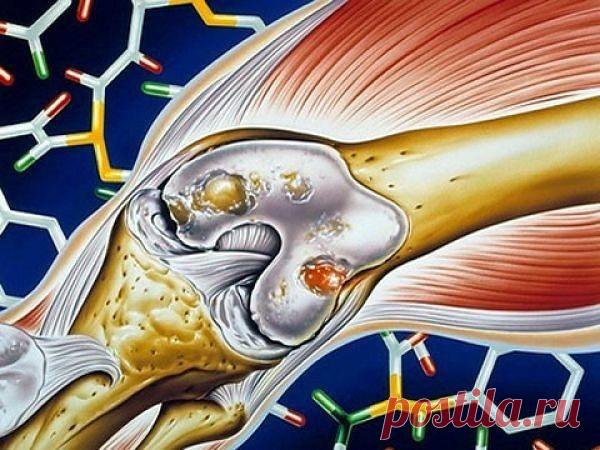 8 РЕЦЕПТОВ ДЛЯ ОЧИЩЕНИЯ СУСТАВОВ!!!