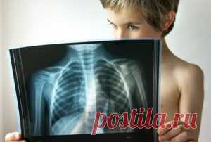 7 признаков того, что простуда перетекла в пневмонию Пневмония — это воспаление легких, которое грозит серьезными осложнениями при отсутствии надлежащего лечения. Она может развиться как следствие простуды или аллергии, а также может быть результатом травмы грудной клетки. Пневмонию можно заподозрить по ряду симптомов, о которых эксперты и решили напомнить. Кто подвержен? Пневмония может проявиться как у детей, так и у взрослых. Но, по […]