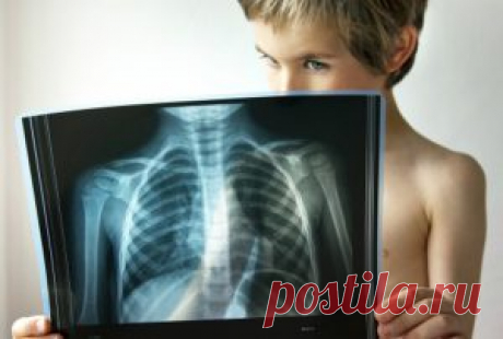 7 признаков того, что простуда перетекла в пневмонию Пневмония — это воспаление легких, которое грозит серьезными осложнениями при отсутствии надлежащего лечения. Она может развиться как следствие простуды или аллергии, а также может быть результатом травмы грудной клетки. Пневмонию можно заподозрить по ряду симптомов, о которых эксперты и решили напомнить. Кто подвержен? Пневмония может проявиться как у детей, так и у взрослых. Но, по […]