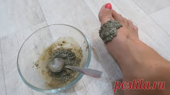 Эффективный СПОСОБ избавиться от косточки на ногах