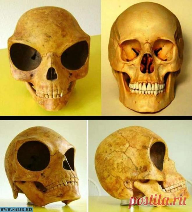 Череп острова Силенд: Ученые не знают, кому он принадлежит - Мир пристрастен - медиаплатформа МирТесен