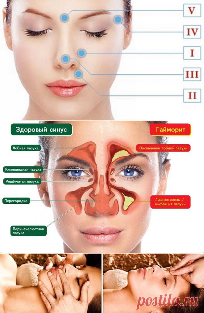 Избавься от инфекции носовых пазух всего за 5 минут! Знать бы этот метод раньше… — Копилочка полезных советов