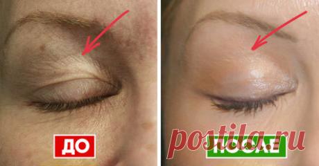 Как вернуть молодость коже век: 5 проверенных средств, которые не дадут тебе лечь под нож. Я выбираю домашний способ!