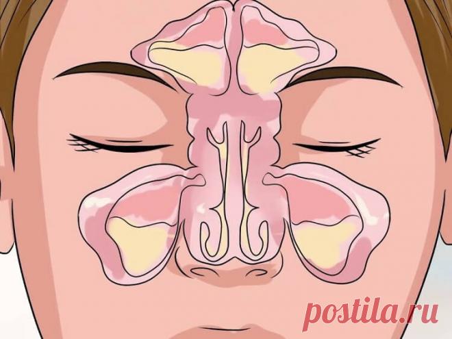 Как вывести слизь из организма и стать здоровее на 10 лет?