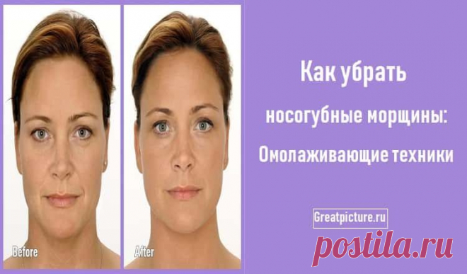Как убрать носогубные морщины: Омолаживающие техники