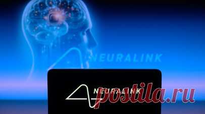 Business Insider: пациент с чипом Neuralink пользуется им почти весь день. Первый человек с имплантом Neuralink в мозге Нолан Арбо рассказал, что может использовать его на протяжении всего дня, сообщает издание Business Insider. Читать далее