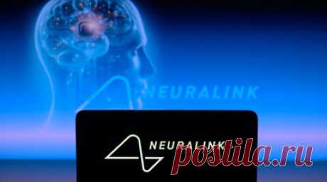Business Insider: пациент с чипом Neuralink пользуется им почти весь день. Первый человек с имплантом Neuralink в мозге Нолан Арбо рассказал, что может использовать его на протяжении всего дня, сообщает издание Business Insider. Читать далее
