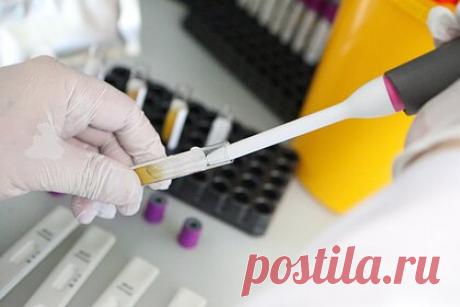 Ученые обнаружили сезонность в распространении коронавируса. Ученые из Барселонского института глобального здравоохранения (ISGlobal), Испания обнаружили у коронавируса признаки сезонности. Согласно исследованию, более высокие темпы передачи вируса связаны с более низкими температурами и влажностью. По мере их повышения волны пандемии ослабевали.