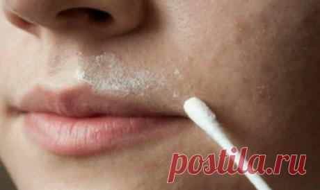 Природный рецепт удаления усиков на лице — Копилочка полезных советов