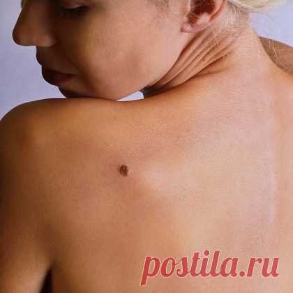 Удаление новообразований в Центре коррекции фигуры Евро-Шарм, Абакан
Удаление папиллом, бородавок и родинок

Удаления новообразований на лице и теле В Центре медицинской косметологии "Евро-Шарм" проводится двумя самыми передовыми методами. Один из них - метод радиоволновой терапии на аппарате "Сургитрон" (США), а второй  - метод лазерного фототермолиза, то есть испарение новообразований лучем лазера, на лазерном комбайне DEKA SMARTXIDE DOT (Италия).