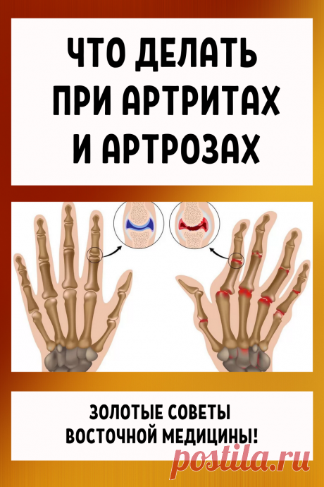 Что делать при артритах и артрозах... Золотые советы восточной медицины.