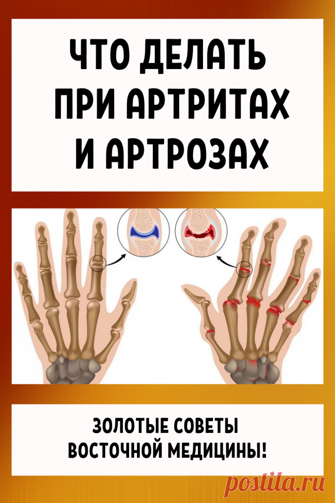 Что делать при артритах и артрозах... Золотые советы восточной медицины!