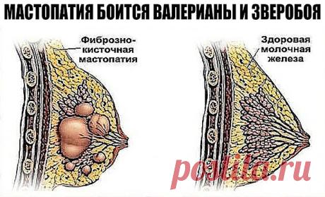 (90) Одноклассники
