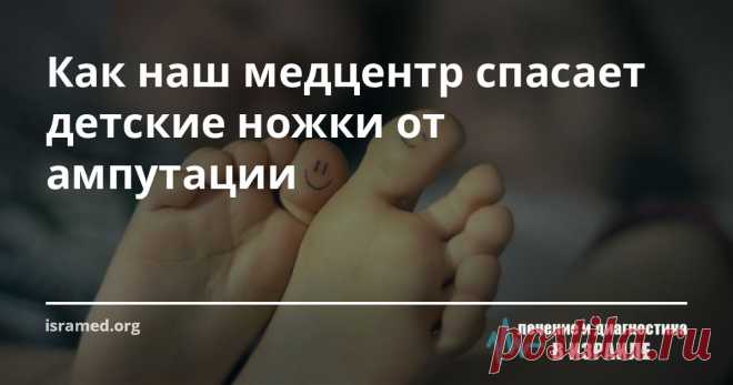 Как наш медцентр спасает детские ножки от ампутации Эта история об одной девушке, которой уже исполнилось 27 лет. Сегодня она может ходить только благодаря необычной операции, которую выполнили израильские врачи.