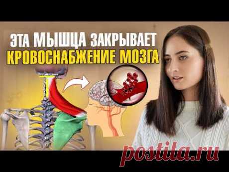 Плохое кровоснабжение мозга, боль в шее, инсульт, повышение давления — всё из-за ЭТОЙ мышцы