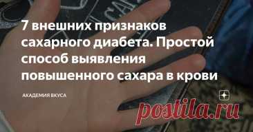 7 внешних признаков сахарного диабета. Простой способ выявления повышенного сахара в крови Статья автора «Академия Вкуса » в Дзене ✍: "Я ведь чувствую себя нормально, зачем мне сдавать анализы?" — часто говорят люди, не подозревая, что сахарный диабет уже может шагать за ними.