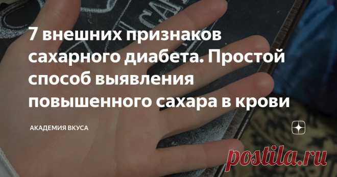 7 внешних признаков сахарного диабета. Простой способ выявления повышенного сахара в крови Статья автора «Академия Вкуса » в Дзене ✍: 