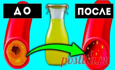 Как очистить сосуды от остатков холестерина за 40 дней! — Совет
