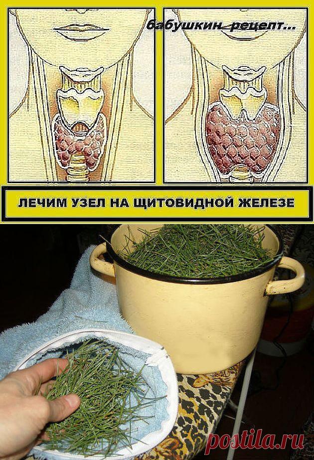 Лечим узел на щитовидной железе и снимаем артериальное давление.