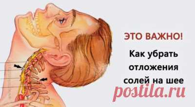 Убираем отложения солей на шее 
Отложение солей на шее называют остеохондрозом шейного отдела позвоночника. Вследствие того, что шейный отдел позвоночника является весьма важной частью организма, нарушения в этой области приводят к…