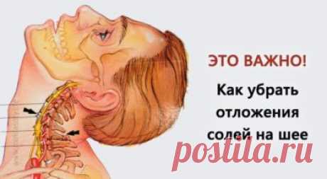 Убираем отложения солей на шее 
Отложение солей на шее называют остеохондрозом шейного отдела позвоночника. Вследствие того, что шейный отдел позвоночника является весьма важной частью организма, нарушения в этой области приводят к…