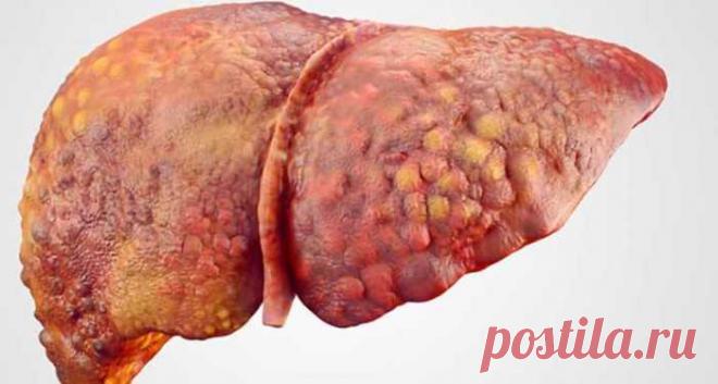 Существует только одно растение, которое может спасти печень и вашу жизнь — Сад Заготовка