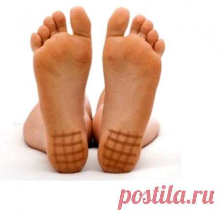 МАЖЬ ПЯТКИ ЙОДОМ, И ВСЕ ПРОЙДЕТ!
ОДОЛЕЛИ СЛАБОСТЬ И АПАТИЯ? СНАБДИТЕ ЩИТОВИДКУ ЙОДОМ
Если вас подводит память, одолевает апатия, не стоит сразу списывать это на авитаминоз и глотать упаковками комплексные препараты с множеством лишних компонентов. Порой достаточно восполнить лишь дефицит йода — и все проблемы как рукой снимет. Нехватка этого важного микроэлемента ведет к снижению функции щитовидной железы — отсюда и все напасти.


Мой отец рассказывал, что, когда он служил...