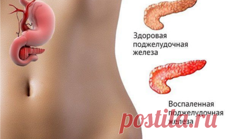 Лечение поджелудочной железы