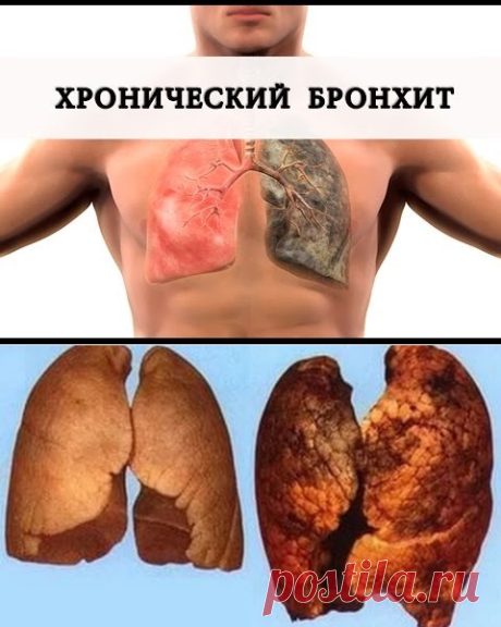 (86) Одноклассники