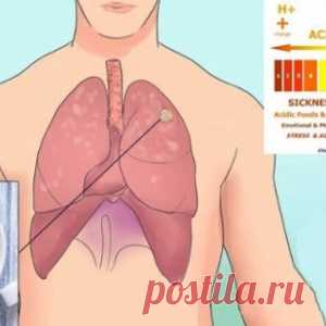 У каждого человека присутствуют в организме раковые клетки. Как помешать им стать опухолью?!?