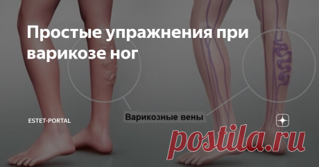 Простые упражнения при варикозе ног Варикозное расширение вен на ногах – довольно распространенная проблема, которая приносит множество неудобств, в том числе связанных с неэстетичным вздутием вен и отечностью, болях в ногах, тяжестью, судорогами. Симптомы заболевания варьируются в зависимости от конкретного случая.
