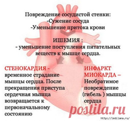 УНИКАЛЬНЫЙ РЕЦЕПТ ЛЕЧЕНИЯ АТЕРОСКЛЕРОЗА И СТЕНОКАРДИИ ОТ ПРОФЕССОРА МАРИНА