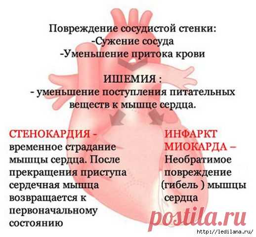 УНИКАЛЬНЫЙ РЕЦЕПТ ЛЕЧЕНИЯ АТЕРОСКЛЕРОЗА И СТЕНОКАРДИИ ОТ ПРОФЕССОРА МАРИНА