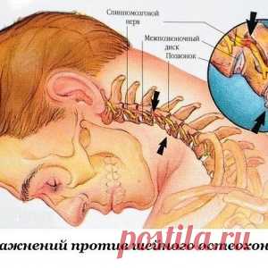 Восемь упражнений против шейного остеохондроза - МирТесен
