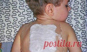 Компресс от сильного кашля! Лечит за вечер.
Хочу поделиться рецептом лепёшки которой всегда пользуюсь при бронхитах:
1 ст. л. мёда,
1 ст. л. сухой горчицы,
1 ст. л. уксуса,
1 ст. л. подсолнечного масла,
муки столько,чтобы можно было лепить.
Лепёшку на грудки или спинку кладу под пелёночку(только не целофан!!!),нужно туго обмотать ребёнка шерстяным шарфом и т.п.на всю ночь.
Как известно, мёд обладает свойствами помогающими лечить многие 
заболевания, не прибегая к использованию традиционных лекар