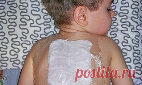 Компресс от сильного кашля! Лечит за вечер.
Хочу поделиться рецептом лепёшки которой всегда пользуюсь при бронхитах:
1 ст. л. мёда,
1 ст. л. сухой горчицы,
1 ст. л. уксуса,
1 ст. л. подсолнечного масла,
муки столько,чтобы можно было лепить.
Лепёшку на грудки или спинку кладу под пелёночку(только не целофан!!!),нужно туго обмотать ребёнка шерстяным шарфом и т.п.на всю ночь.
Как известно, мёд обладает свойствами помогающими лечить многие 
заболевания, не прибегая к использованию традиционных лекар