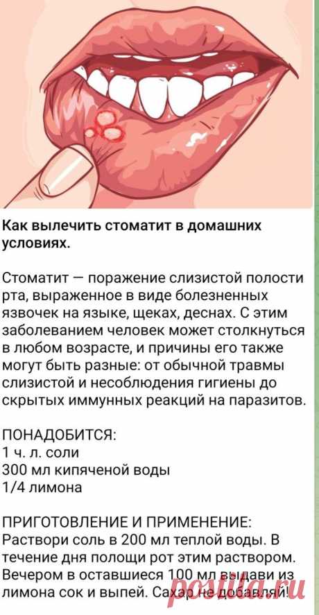 (1527) Pinterest