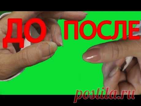 Как починить сломанный ноготь