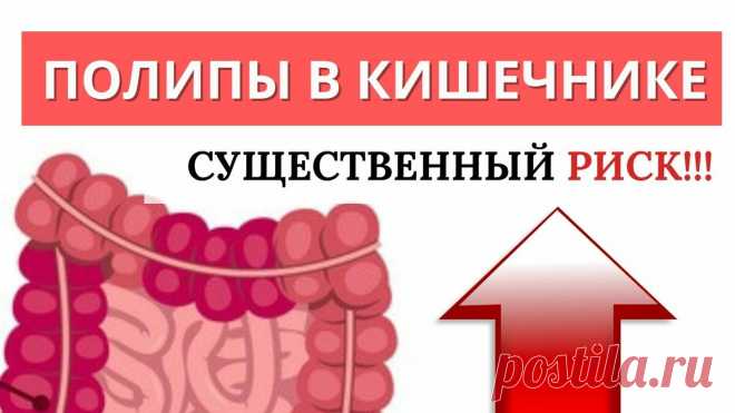 Почему образуются полипы в кишечнике. Как от них избавиться? | Система Соколинского. Видео. Исследования | Дзен