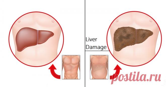 7 ранних предупреждений о повреждении печени, которые вы никогда не должны игнорировать - Журнал Советов Правильно функционирующая печень жизненно важна для нашего здоровья. Количество заболеваний печени неуклонно растет с годами. Согласно Национальной статистике в Великобритании, заболевания печени считаются пятой по частоте причиной смерти. Заболевания печени признаны второй по значимости причиной смертности среди всех болезней органов пищеварения в США. Основными функци...