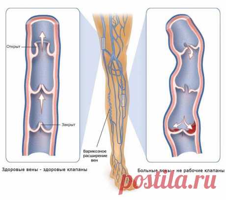 Почему немеют руки: 7 причин, заставляющих задуматься о здоровье.