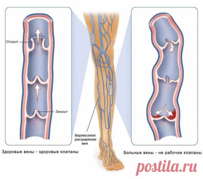 Почему немеют руки: 7 причин, заставляющих задуматься о здоровье.