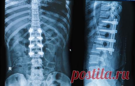 ВНИМАНИЕ! ОРТОПЕДИЧЕСКИЕ КОНСУЛЬТАЦИИ! С 26 по 27 ноября 2016 года немецкий профессор Роланд Беккер проводит ортопедические консультации по адресу:
город Москва, улица Трифоновская 11, (метро Марьина роща или метро Достоевского).
Записаться на консультацию к профессору можно по телефону
+7 (495)961-12-20,
+7 (495)120-46-92,
воспользовавшись электронной почтой info@euromed.academy или формой обратной связи сайта  www.wp-german-med.ru